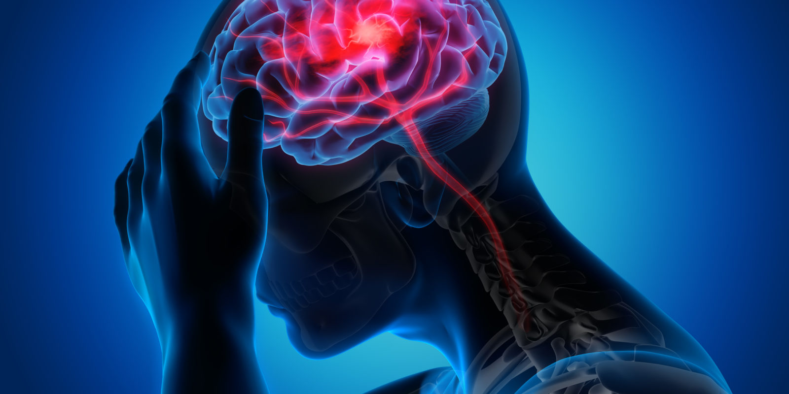 Types of Seizures - Neurology Center For Epilepsy & Seizures