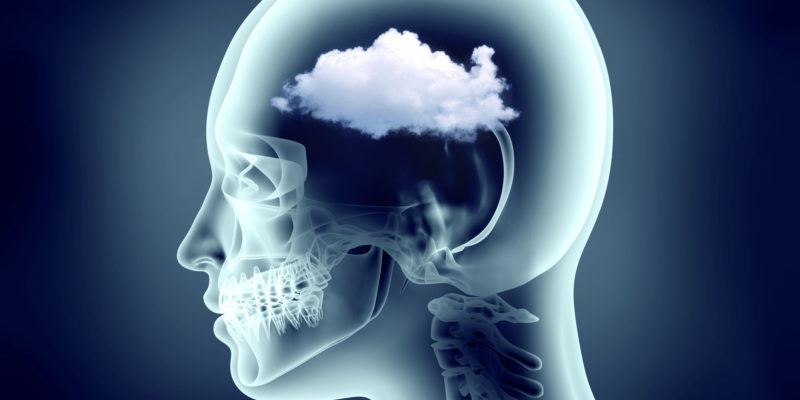 Video EEG Monitoring to Help Understand Brain Fog - Neurology Center For  Epilepsy & Seizures