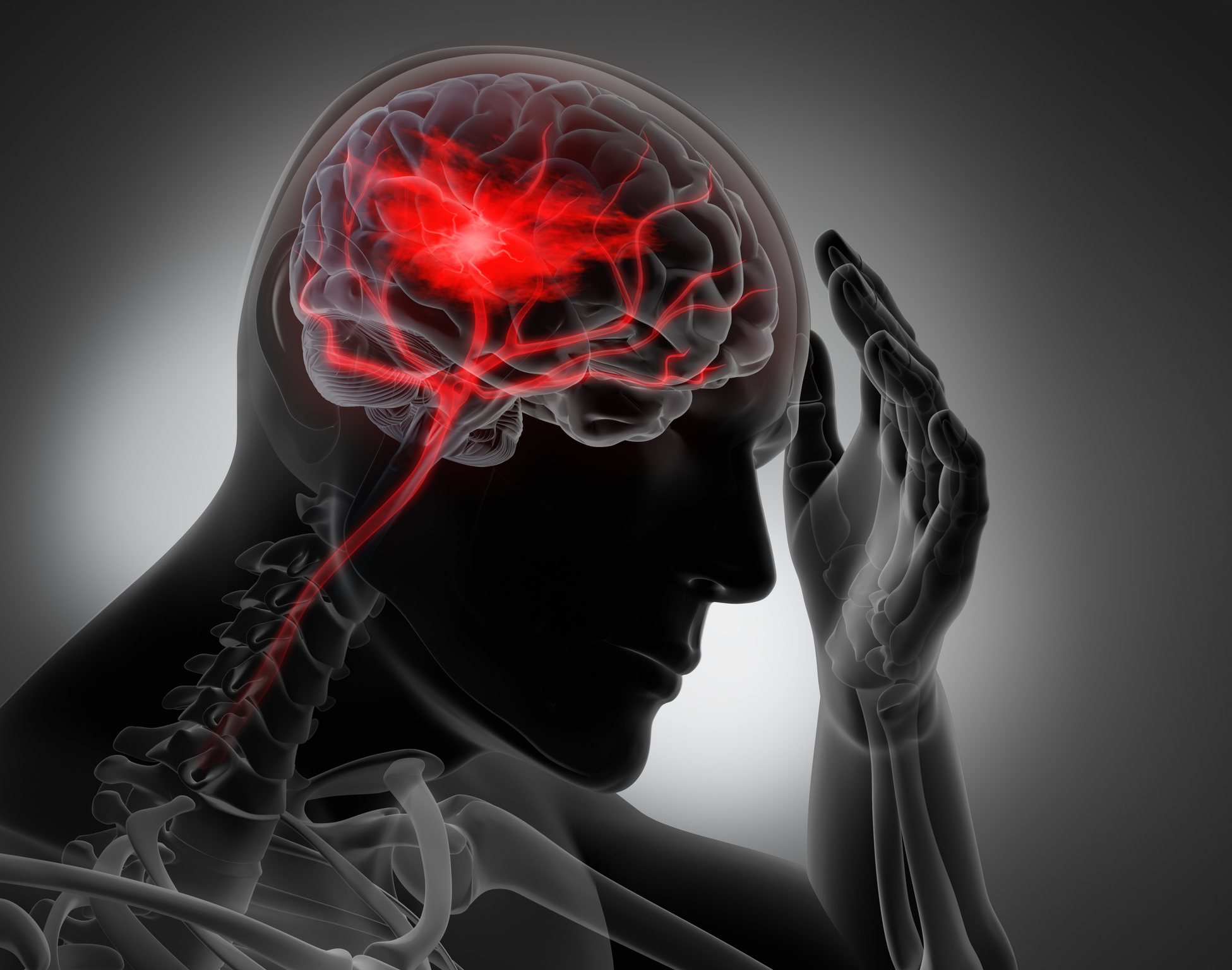 Epilepsy and TBI: What You Need to Know - Neuro Center NJ